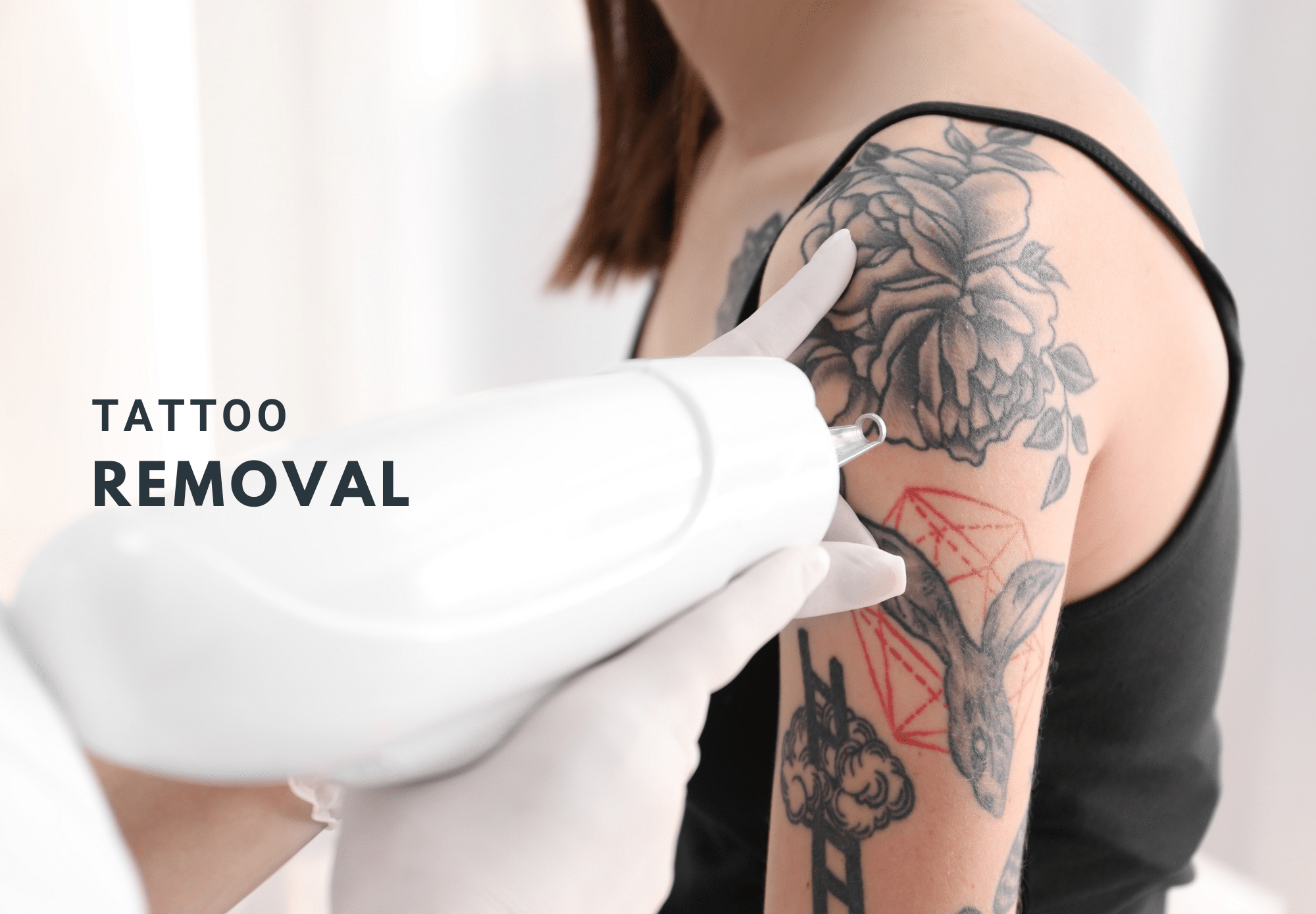 Woman undergoing a tattoo removal treatment.