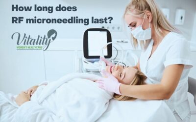 How Long Does RF Microneedling Last?