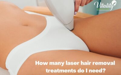 How Many Laser Hair Removal Treatments Do I Need?