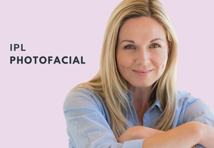 IPL photofacial gainesville texas