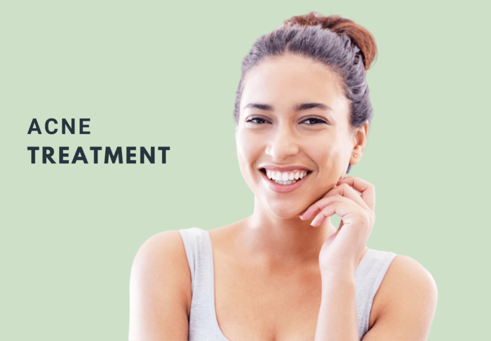 acne treatment gainesville texas