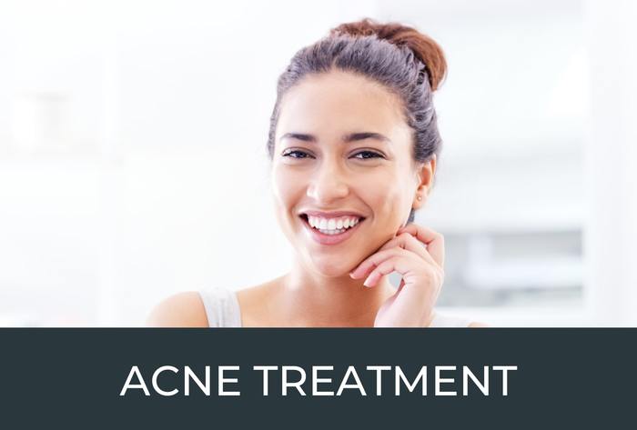 acne treatment