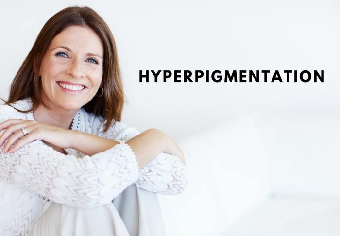 hyperpigmentation gainesville texas