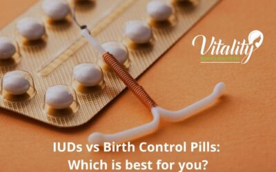 IUDs vs Birth Control Pills: Which is best for you?