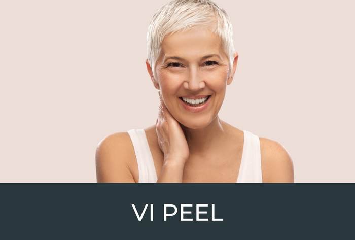 vi peel