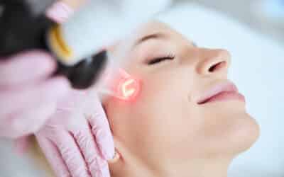 How Long Is Laser Skin Resurfacing Recovery? Here’s Your Holiday Recovery Guide