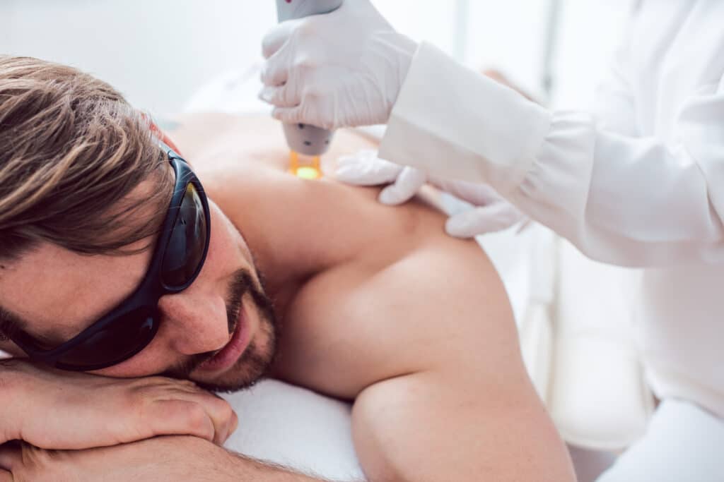 Man undergoing laser hair removal treatment on his back.