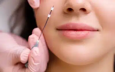 Smooth vs. Barbed PDO Threads: Which Thread Lift Is Right for You?