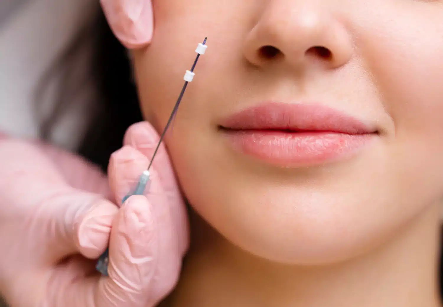 Perfect your Valentine's Day! 3 Treatments to look your best.