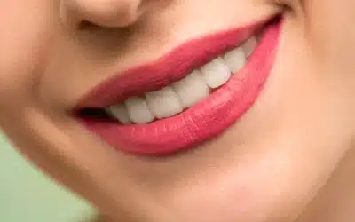 The Best Smile Line Treatments in Gainesville, TX