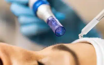 Microneedling: The #1 Trusted Treatment in Skin Rejuvenation