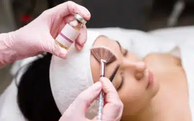 Chemical Peels: Skin Resurfacing for Women in Their 30s, 40s & 50s