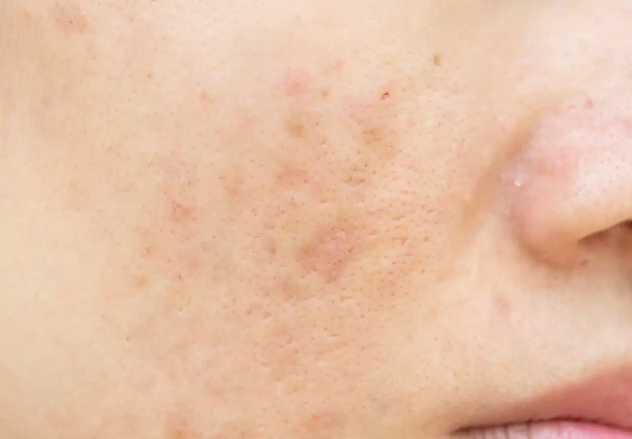 Perfect your Valentine's Day! 3 Treatments to look your best.